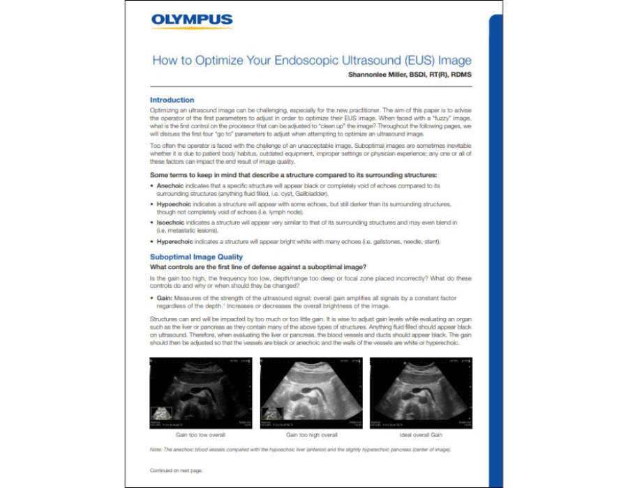 How to Optimize EUS Image