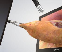 3D Laparoscopic Surgery